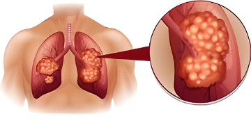 高考交通管制提醒:禅城南海这些考点路段需绕行